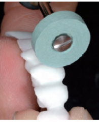 AllCeramic SuperMax